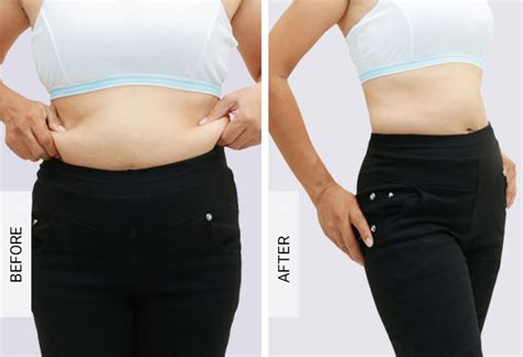 fat cavitation parramatta|Book an Appointment .